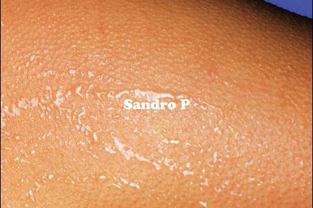 Sandro P – Sandro P